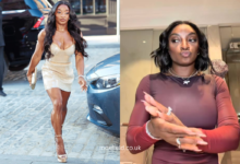 simone biles plastic surgery